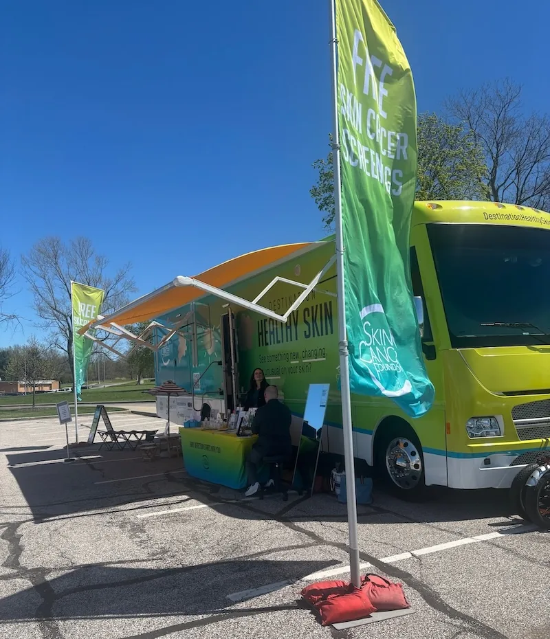 Avery Dennison Wraps Mobile Skin Cancer Screening RV - image 3